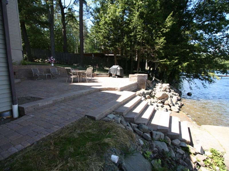 Before & After Gallery